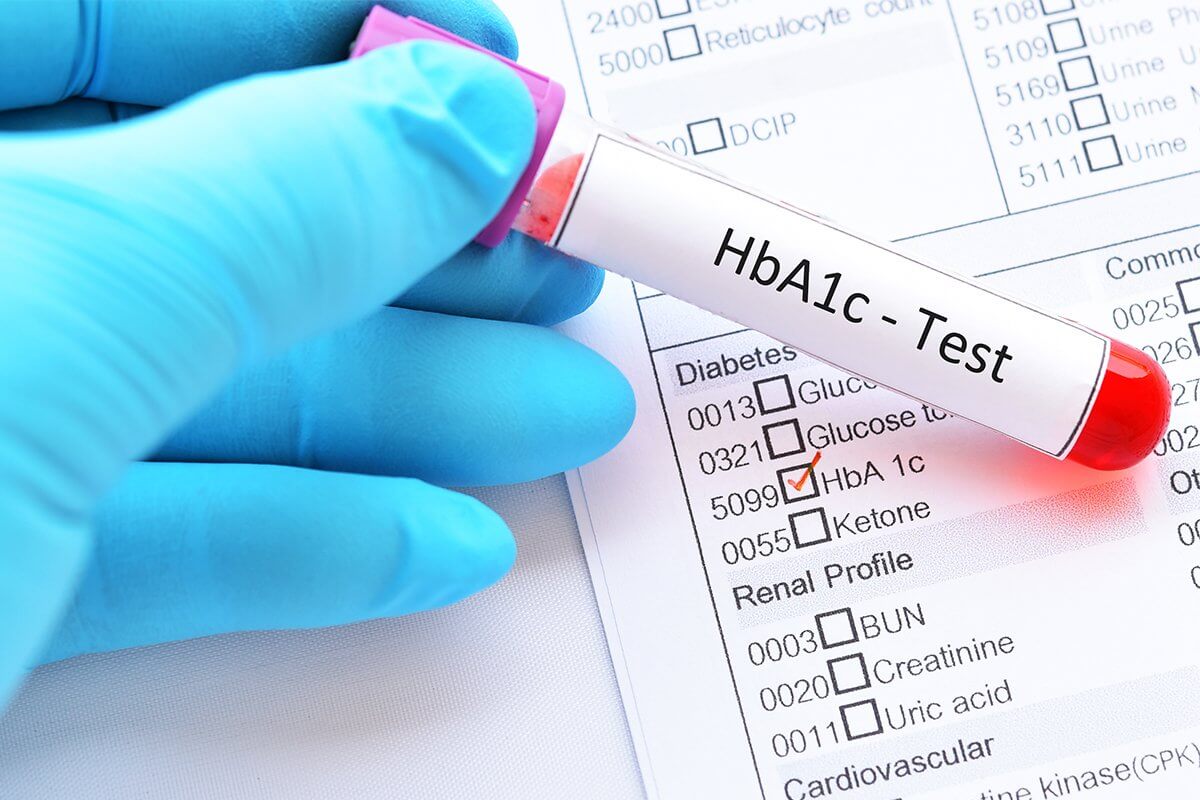 Xét nghiệm hemoglobin A1C