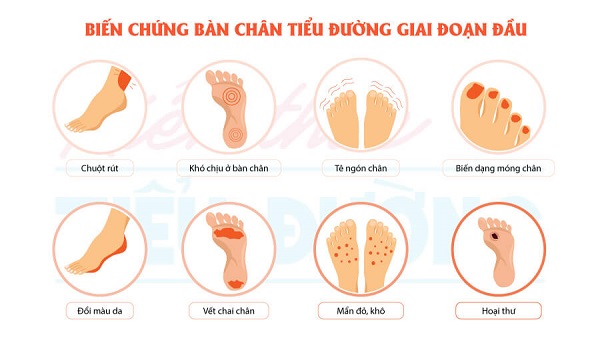 biến chứng bàn chân tiểu đường