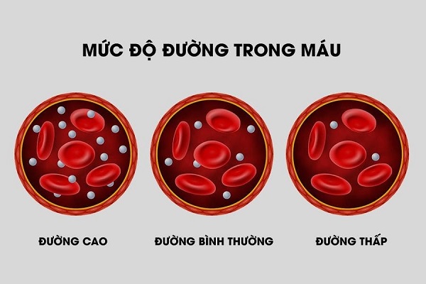 đường huyết cao