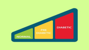 Chẩn đoán tiền tiểu đường 1